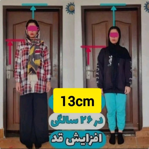 پکیج افزایش قد کاملا واقعی