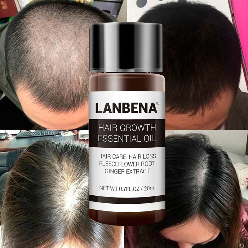روغن رشد مو و ریش لانبنا LANBENA 2