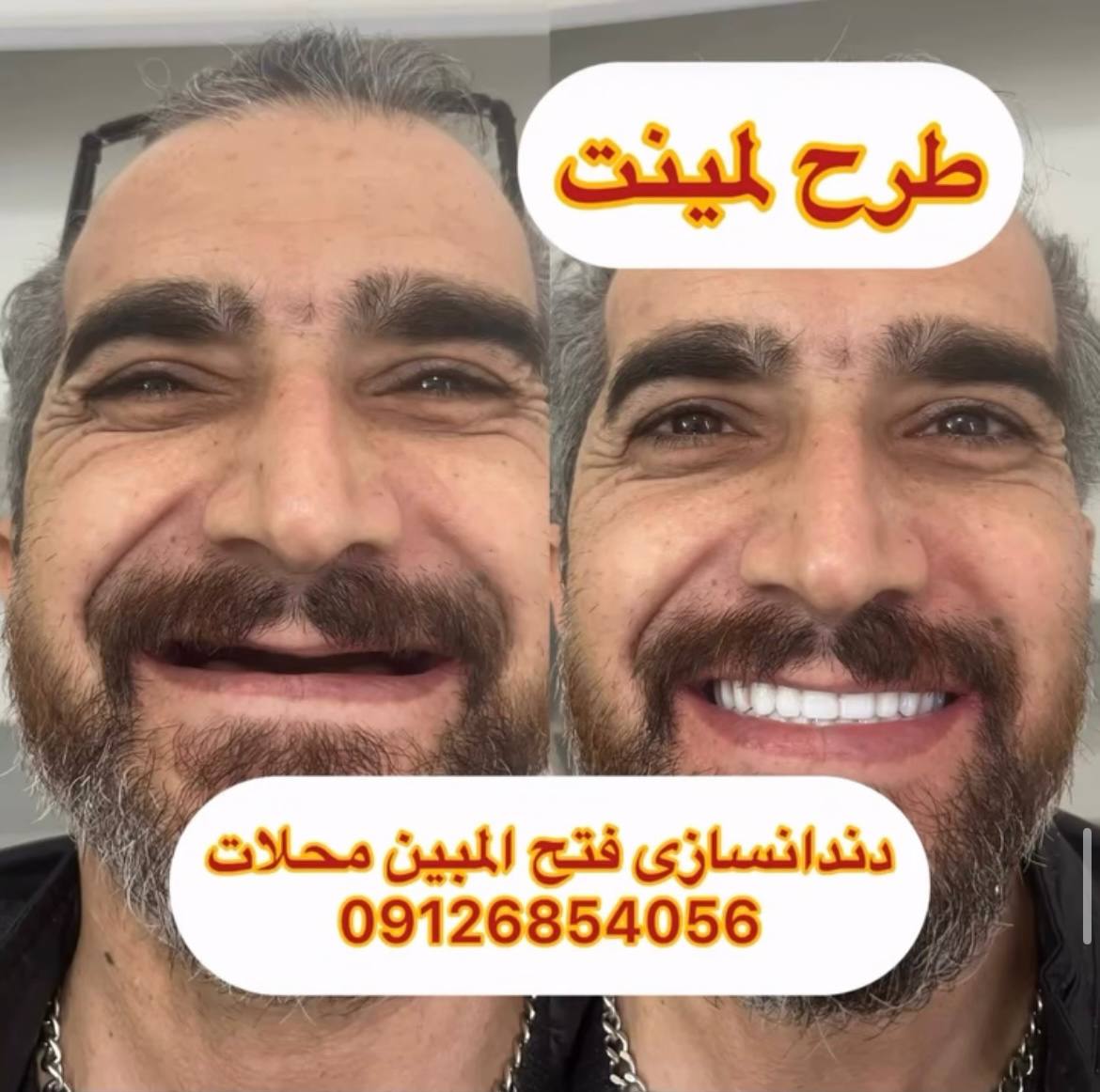 ددندانسازی فتح المبین شهرستان محلات 2