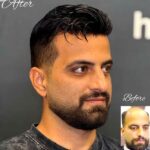 کلینیک پروتز موی آرا در صدتیک