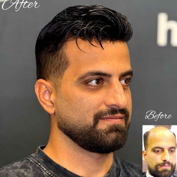 کلینیک پروتز موی آرا