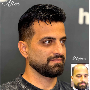 کلینیک پروتز موی آرا