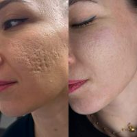 جوانسازی و لیفت و درمان لک و جوش