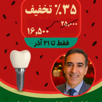 ایمپلنت دیجیتال / کاشت دندان / ویژه یلدا