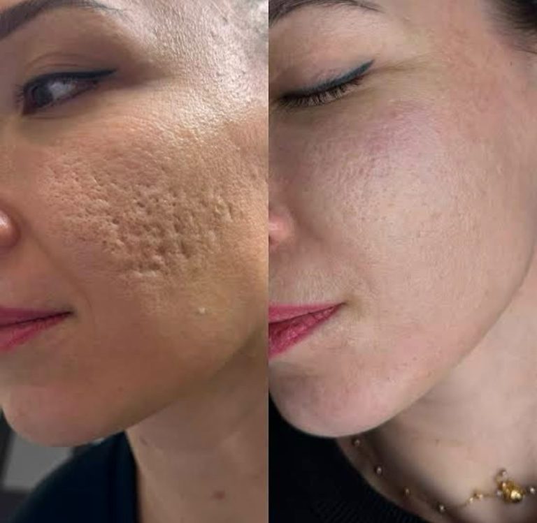 جوانسازی و لیفت و درمان لک و جوش