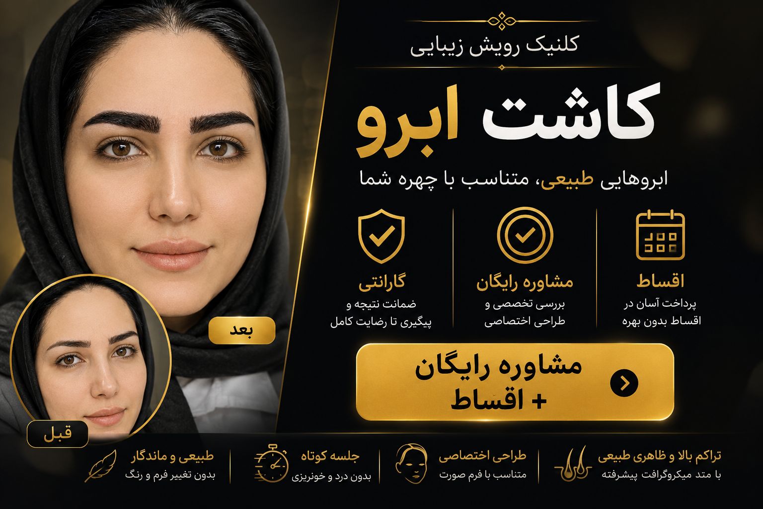 کاشت ابرو دخترونه میکروکاشت 2