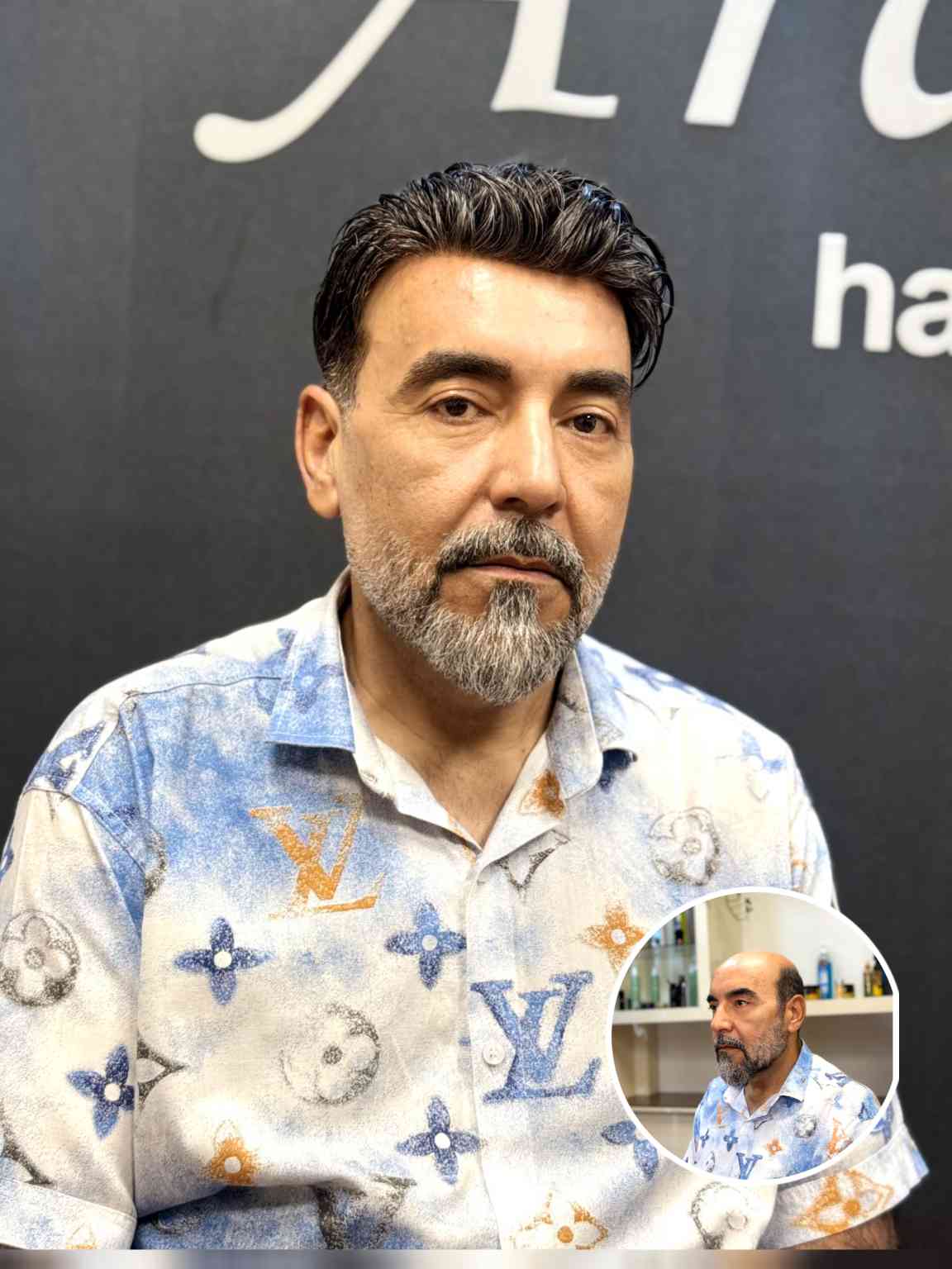 کلینیک پروتز موی آرا 2